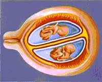 Двуяйцевые близнецы всегда развиваются в отдельных плодных пузырях. У каждого своя собственная плацента. Лишь одна третьоднояйцевых близнецов развивается таким образом.